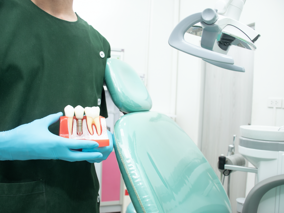 dental implants