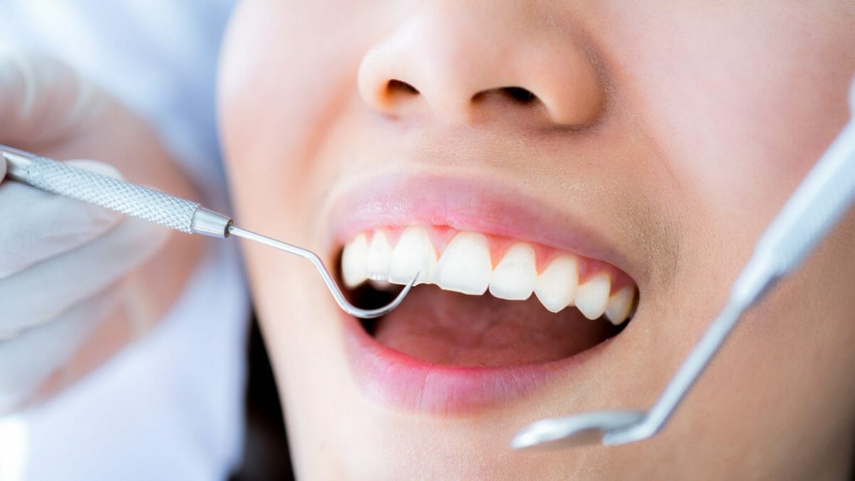 How Often Should I Go to the Dentist for a Teeth Cleaning? 6 Months?