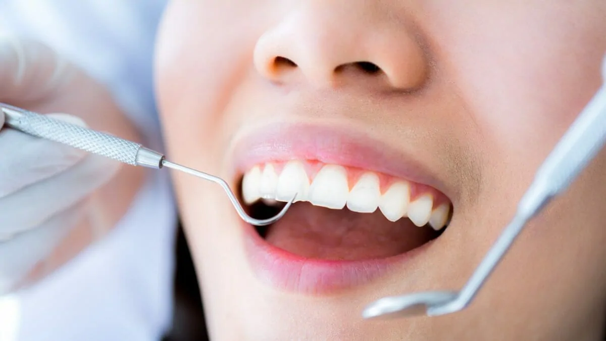 woman getting her teeth cleaned