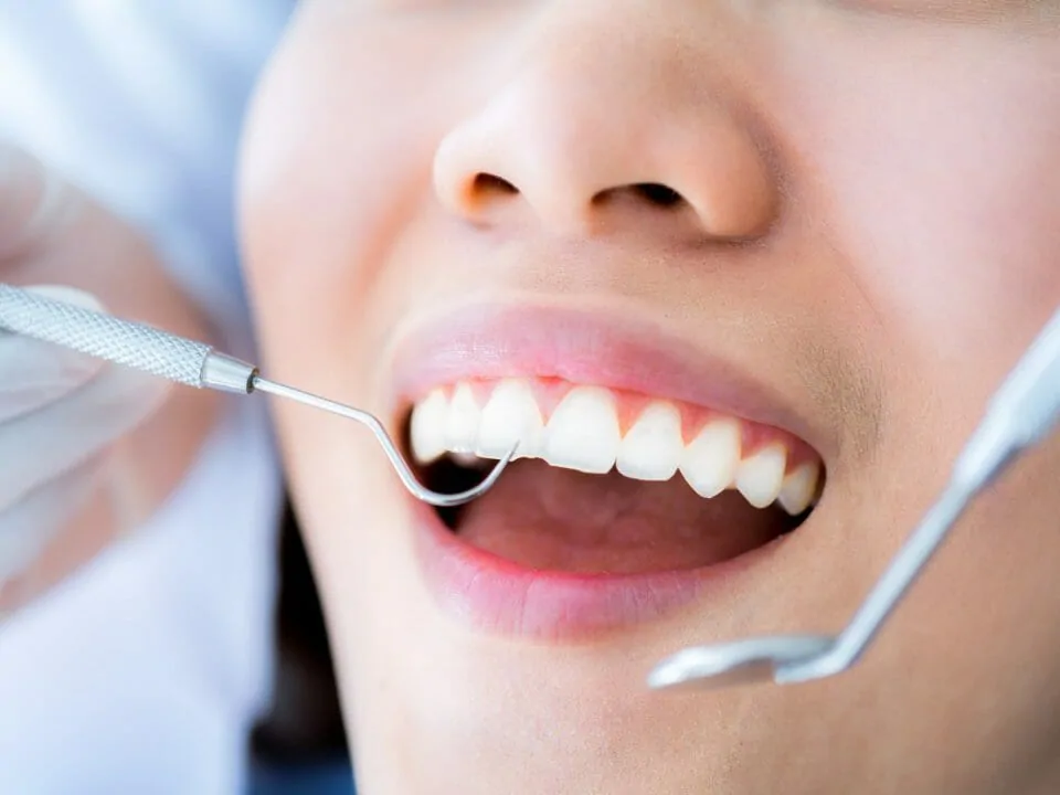 woman getting her teeth cleaned