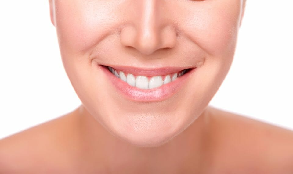 woman with white smile and straight teeth