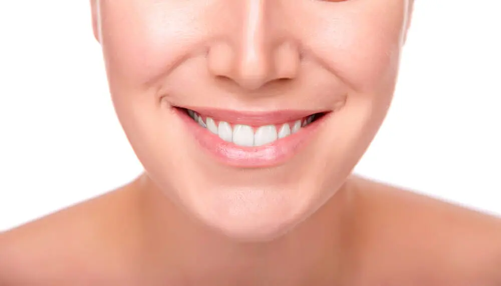 woman with white smile and straight teeth
