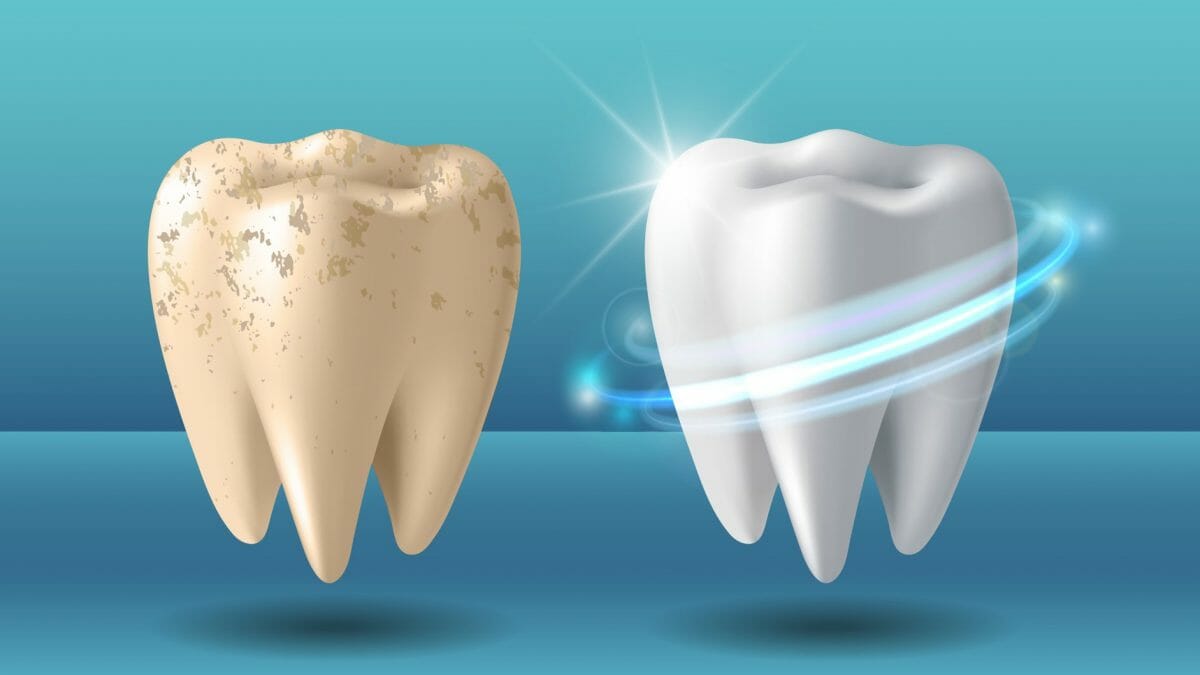 Clean Tooth and Dirty Tooth