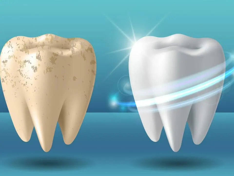 Clean Tooth and Dirty Tooth