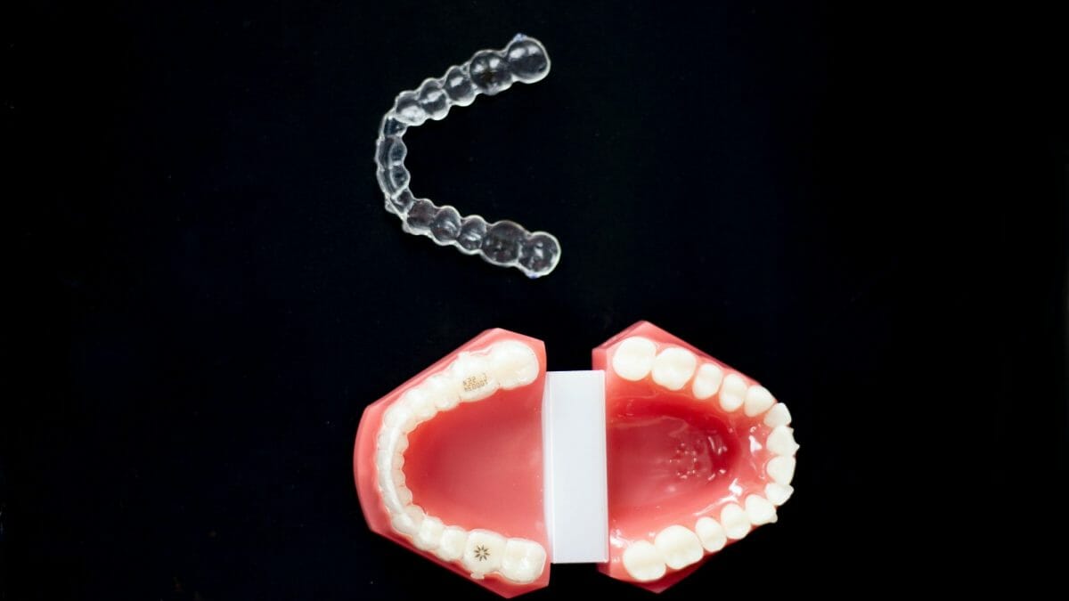 Mouthguard next to Model of Teeth