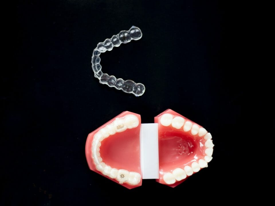 Mouthguard next to Model of Teeth