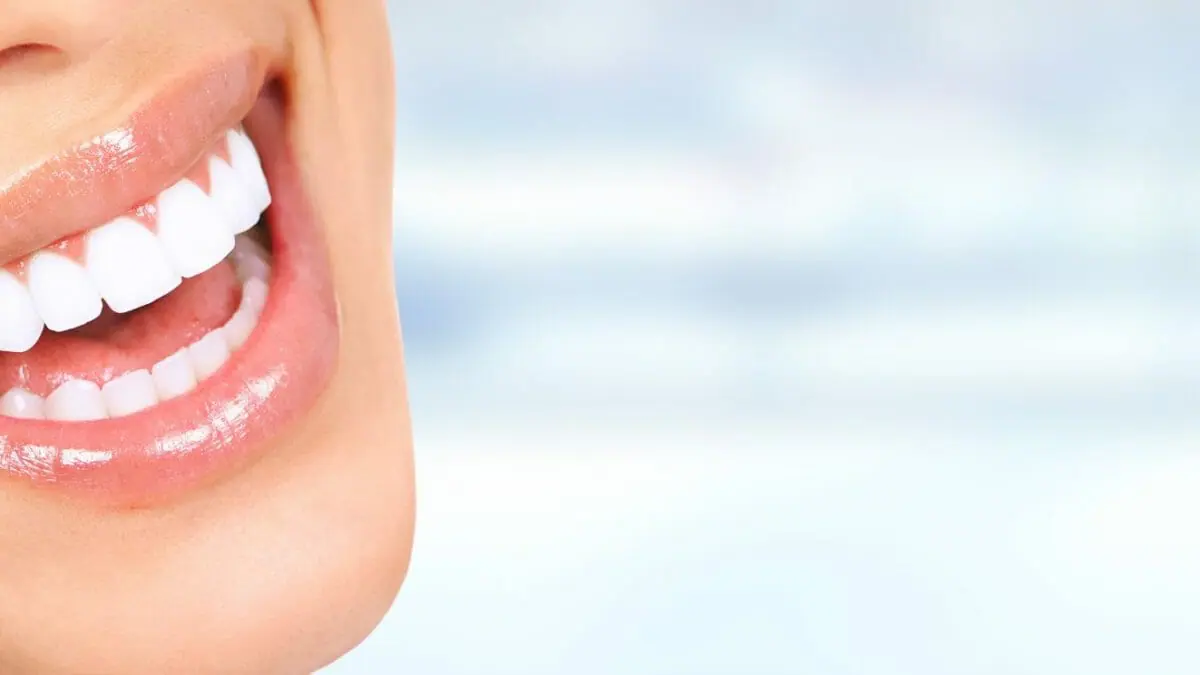 How long does teeth whitening take?