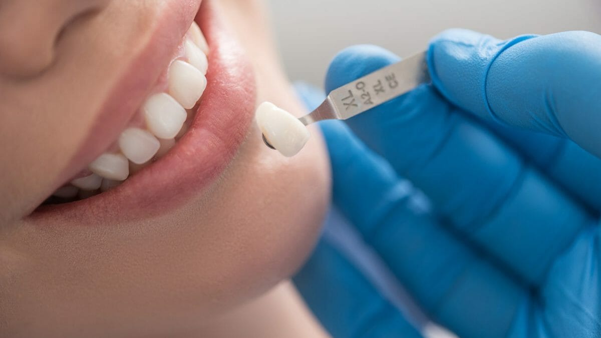 How Dental Crowns Can Improve Your Smile and Oral Health
