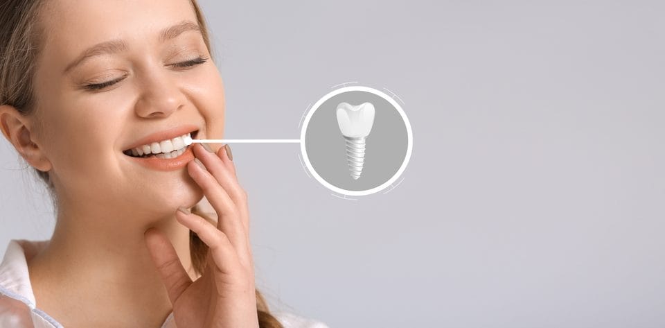 dental implant