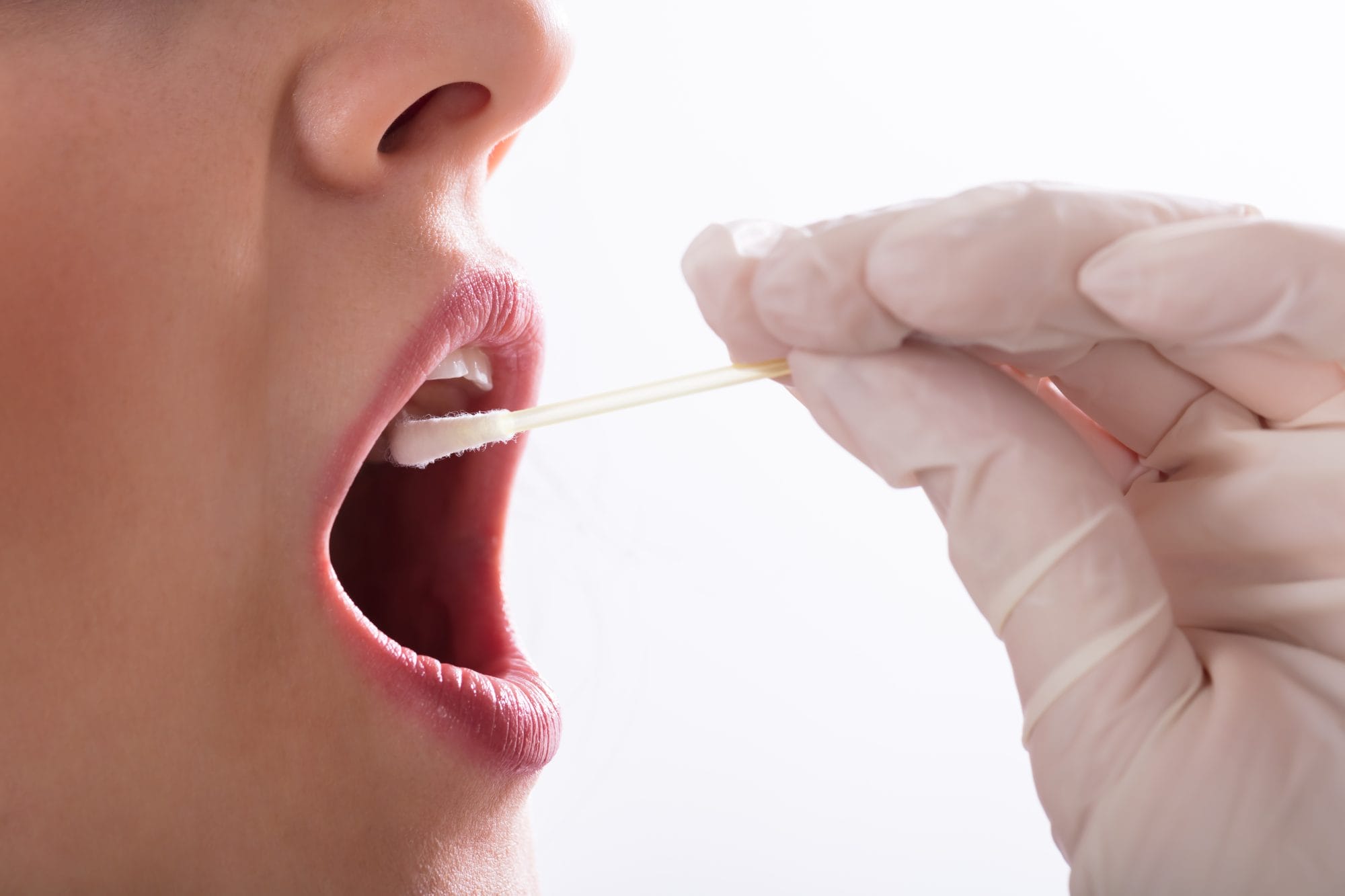 Uncovering the Benefits of Oral DNA Testing - Westerville Dental Associates