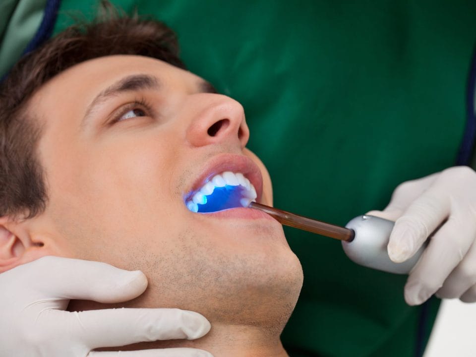 How Dental Sealants Help Prevent Cavities in Kids and Adults
