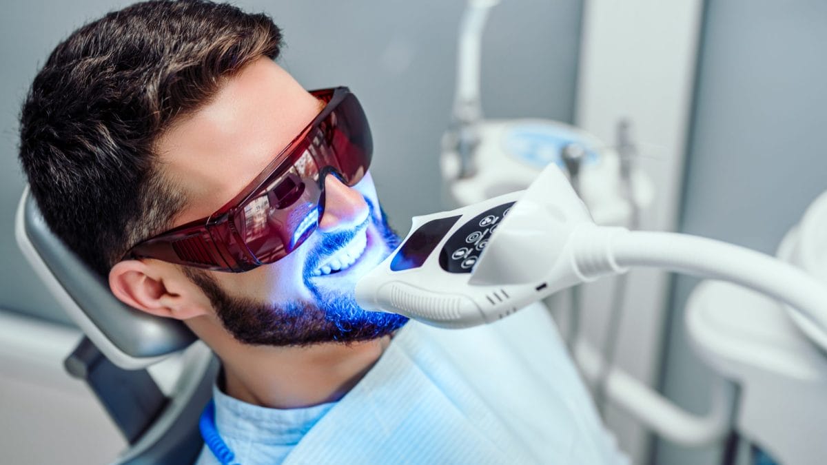 Why Professional Teeth Whitening Is Safer and More Effective Than Store-Bought Kits
