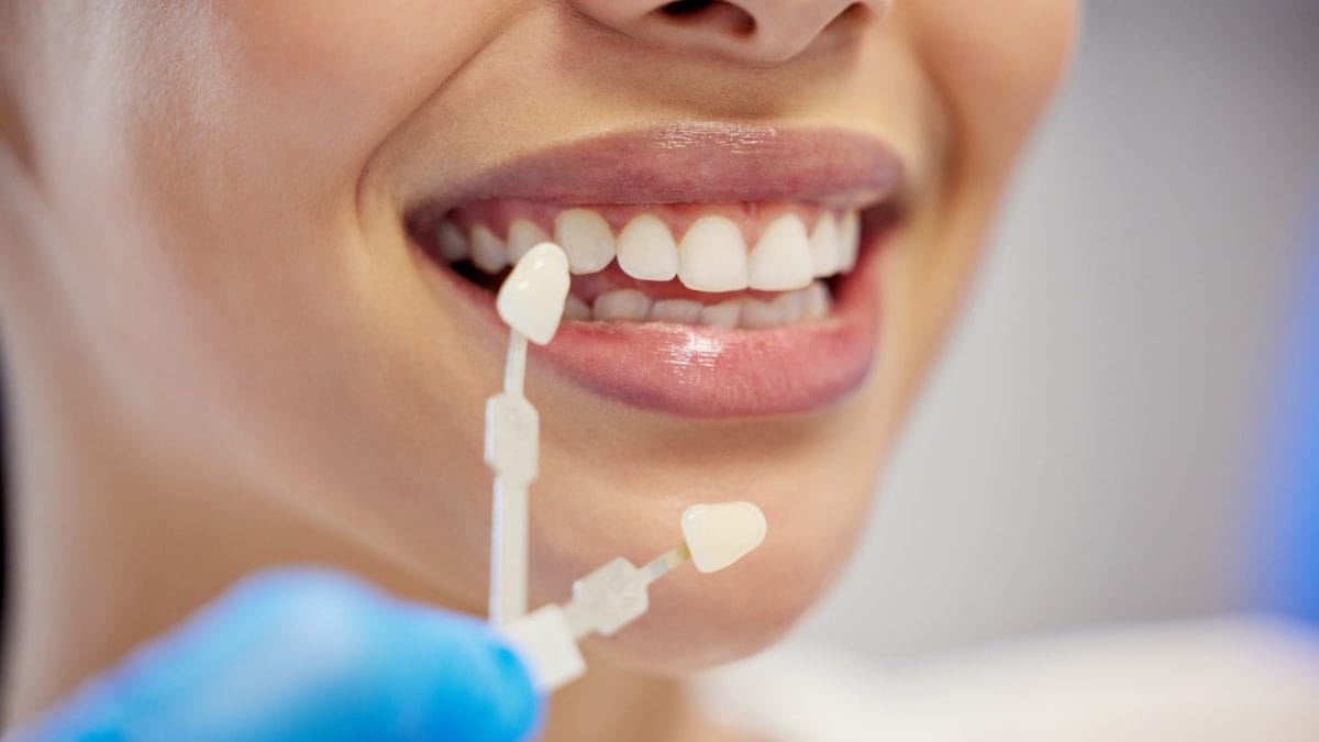 Is Your Smile Holiday-Ready? Cosmetic Dental Treatments That Shine in Fall